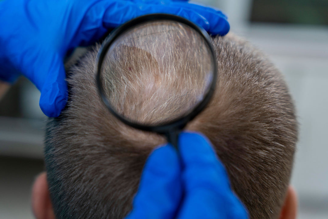 Regrow Confidence: Effective Hair Loss Treatments at Skin Solutions