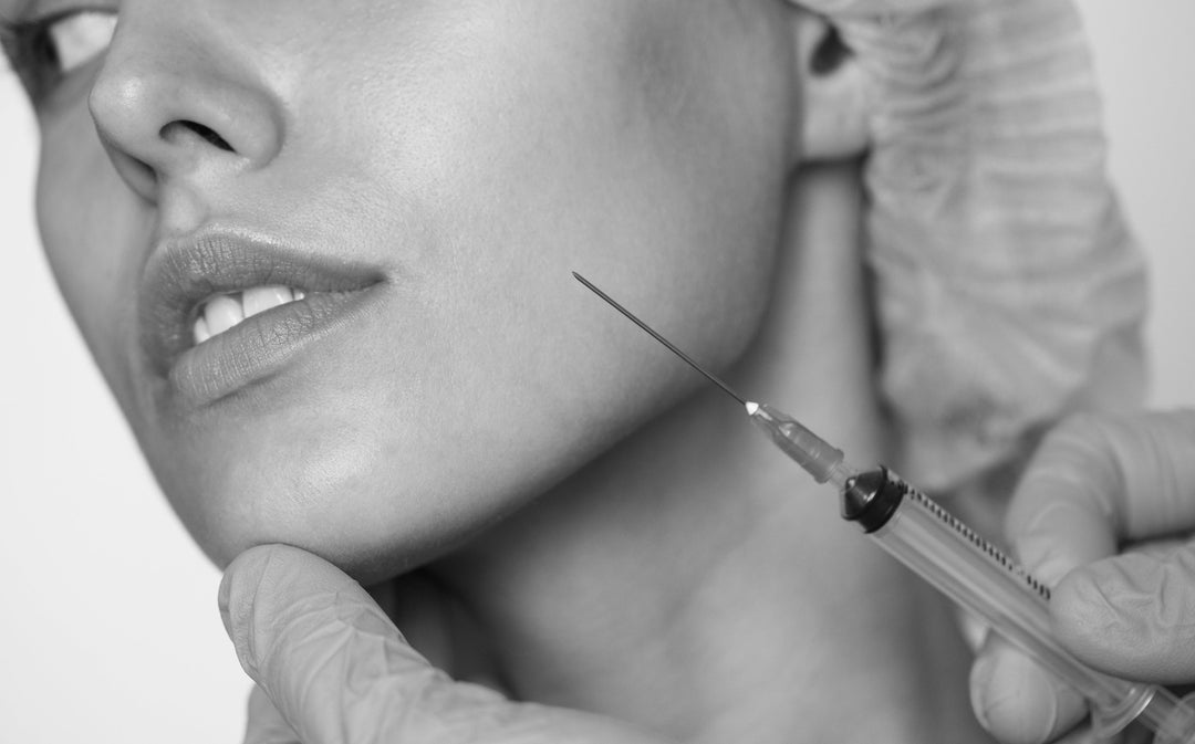 B-tox (Anti-wrinkle injections) - Smooth, Natural Rejuvenation with No Downtime