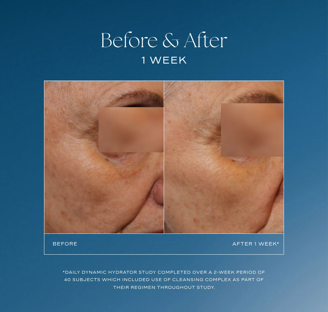 iS Clinical Daily Dynamic Hydrator (50g)