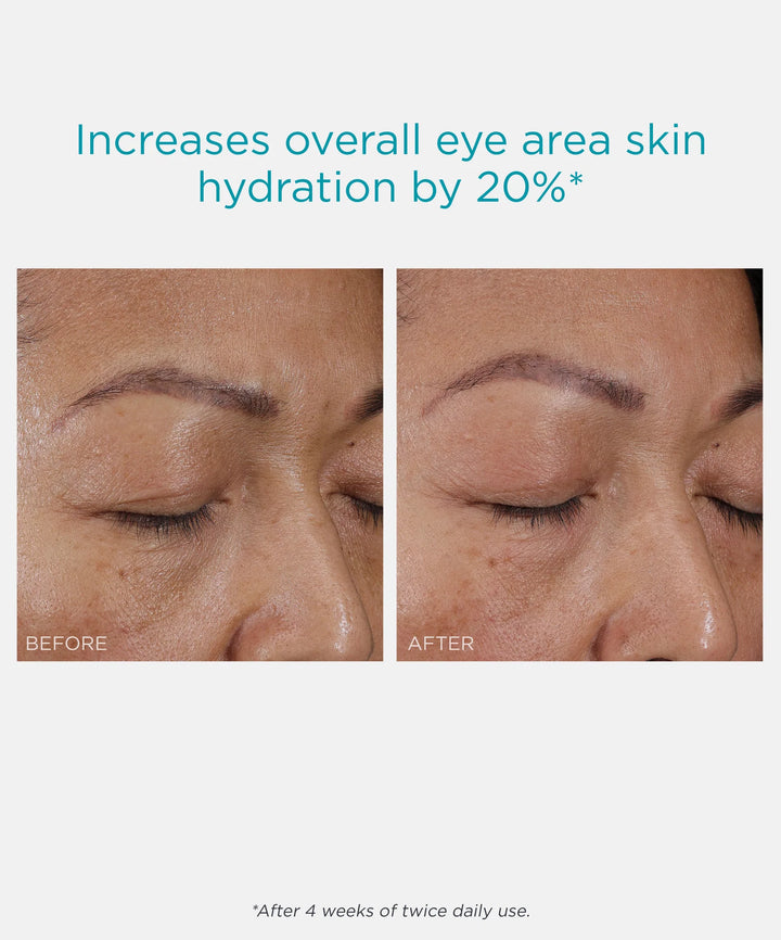 Neostrata Hydra Filling PHA Eye Cream 15g