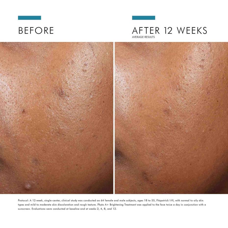 SkinCeuticals Phyto A+ Brightening Treatment 30ml