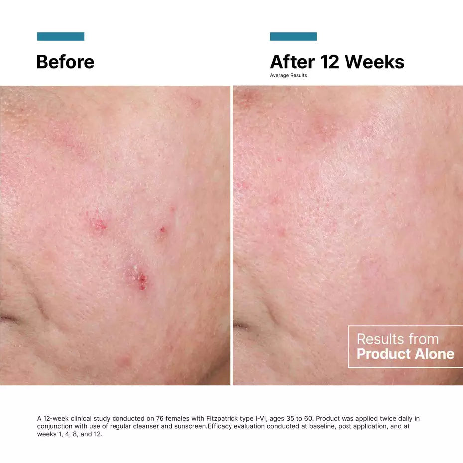 SkinCeuticals Advanced RGN-6 50ml
