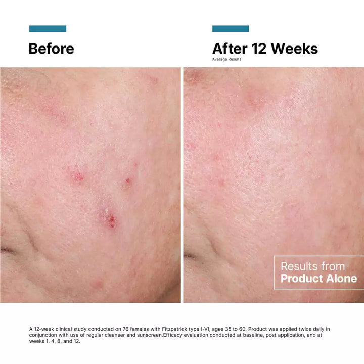 SkinCeuticals Advanced RGN-6 50ml