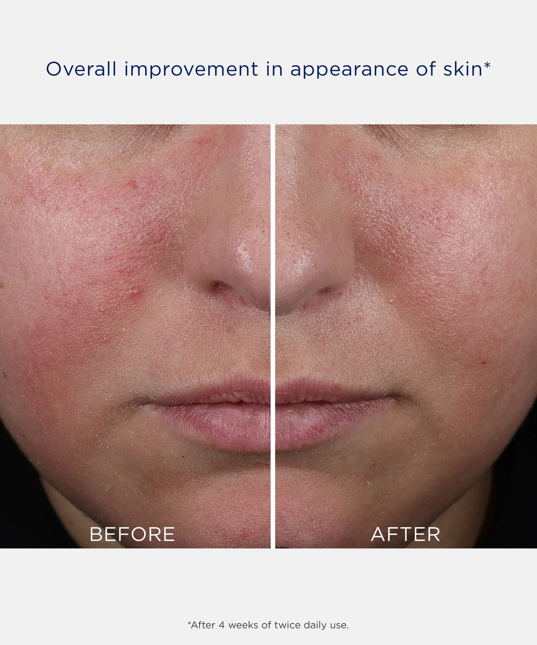 Neostrata Mandelic Clarifying Hydragel 50ml